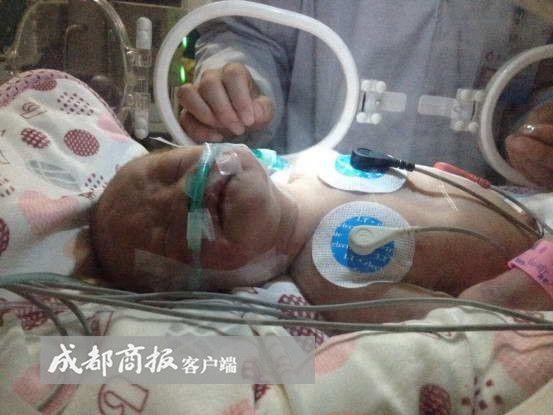 Female Doctor Creates Makeshift Respirator, Saves Newborn