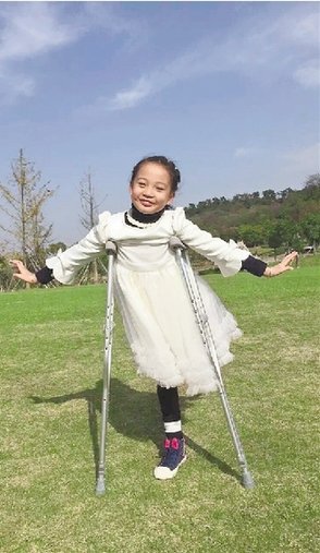 Young Dancer Completes Debut Performance with Artificial Limb